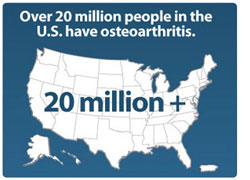 Over 20 Million People in the United States have Osteoarthritis