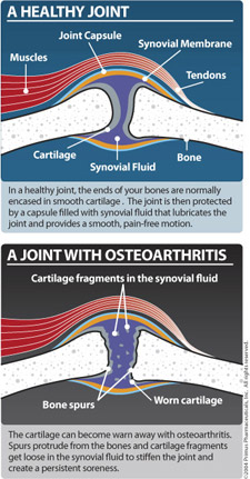 A Helthy Joint