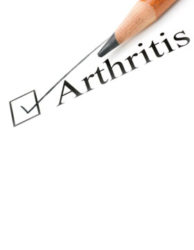 Osteoarthritis Causes