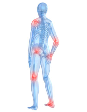 Osteoarthritis Inflammation